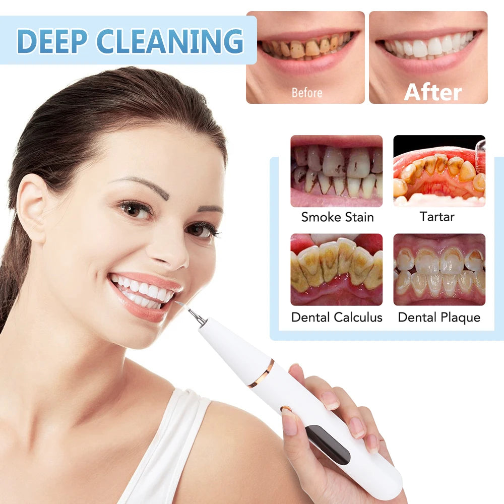 Teeth Cleaner Smoke Stains Plaque